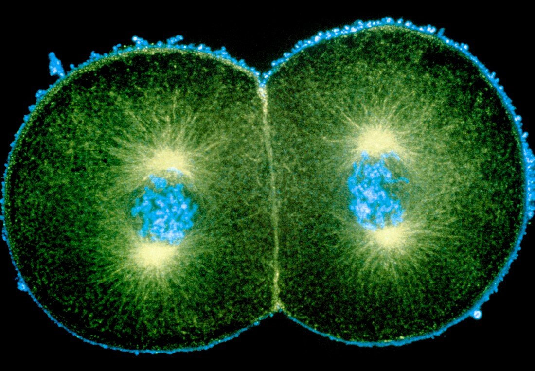 Immunofluorescent micrograph of sea urchin mitosis