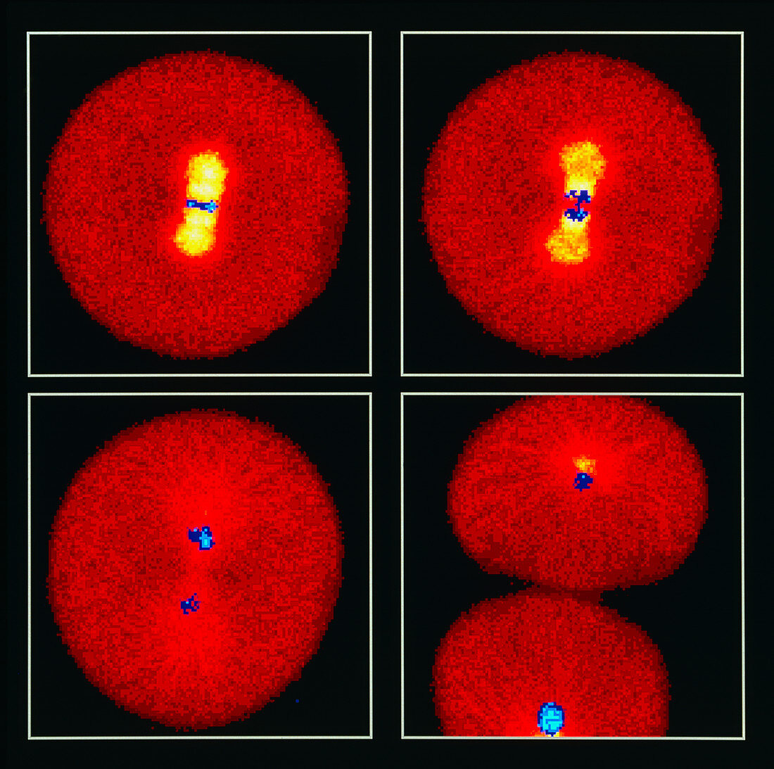 Confocal LM of sea urchin egg: 4 stages of mitosis