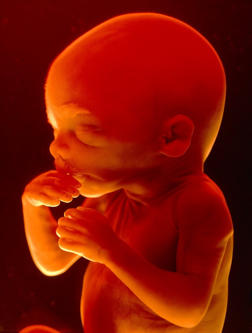 Foetus aged 5 months
