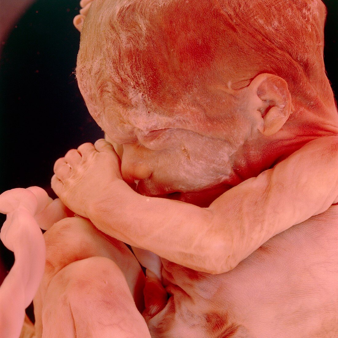 Foetus aged 15 weeks
