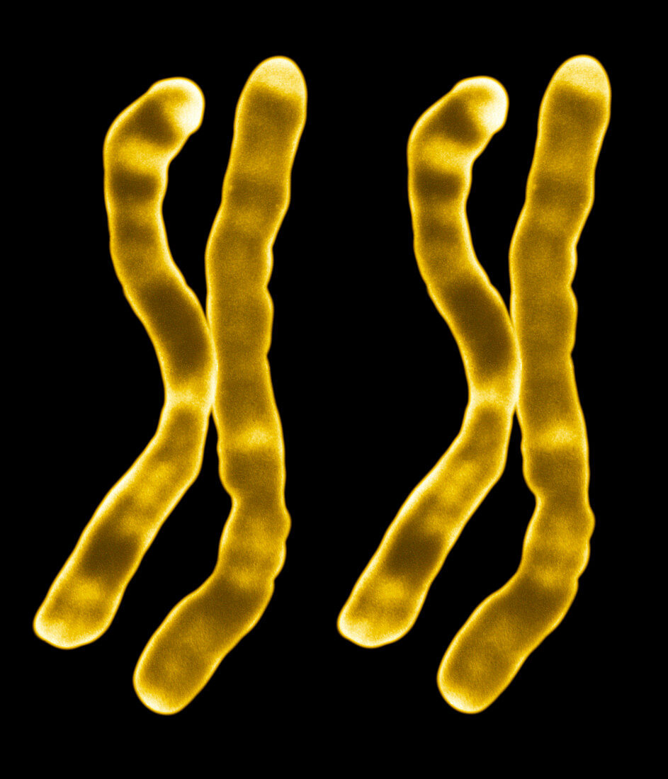 X chromosomes