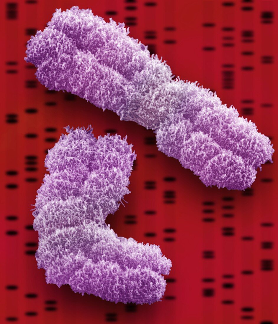 Chromosomes,SEM