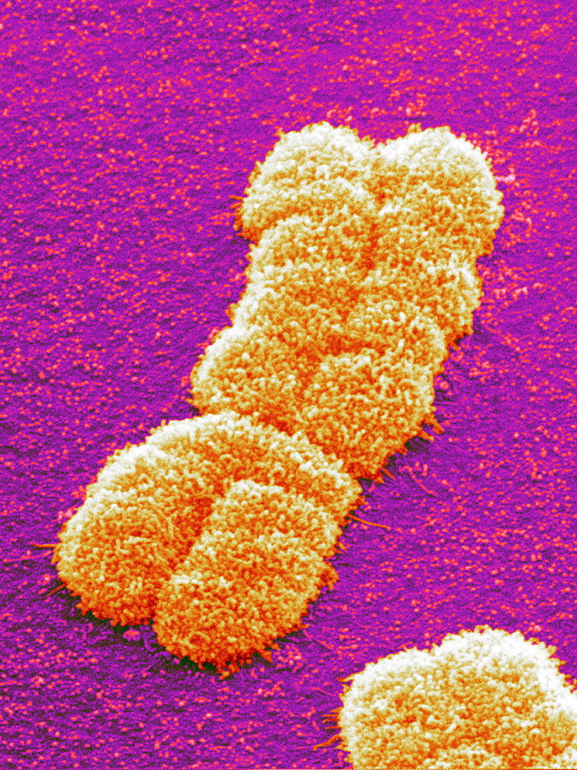 Human chromosome pair,SEM