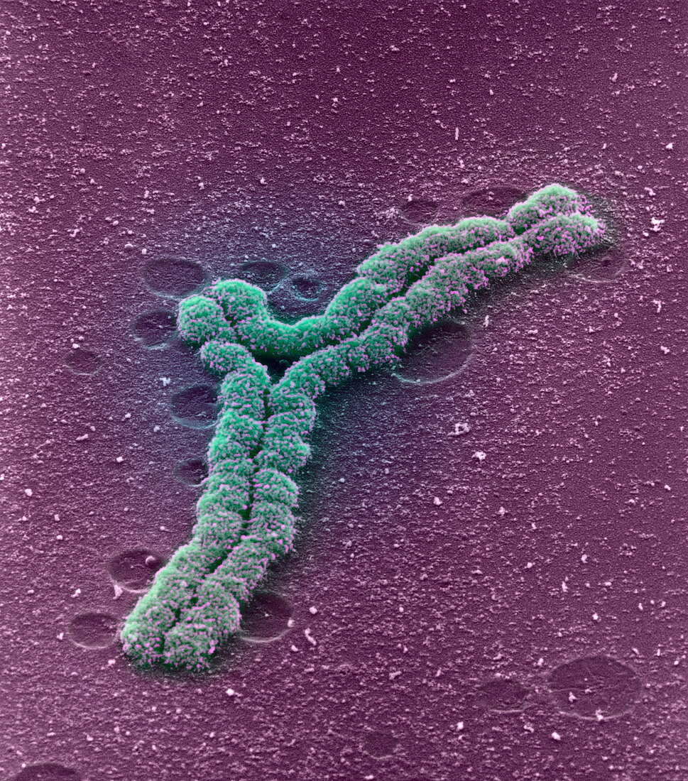 Chromosome rearrangement,SEM