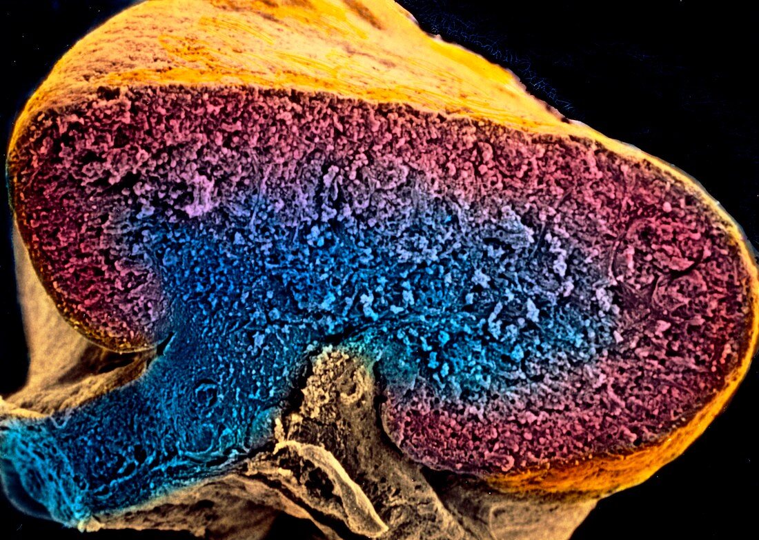 SEM of a sectioned ovary at9-10 weeks of pregnancy