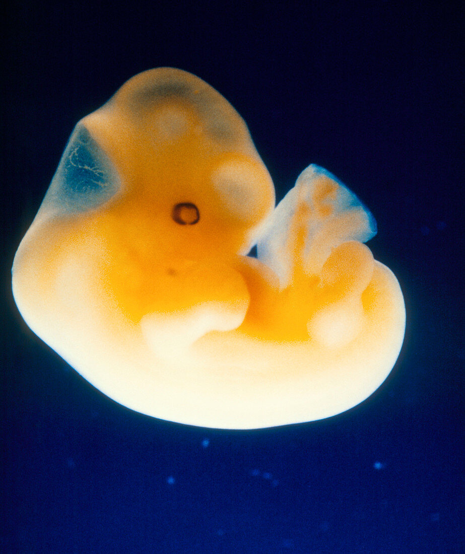 Human embryo at five weeks of gestation