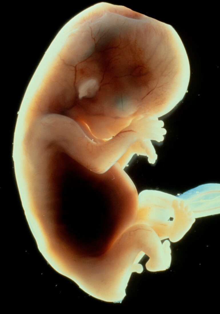 Side view of an eleven week old human foetus