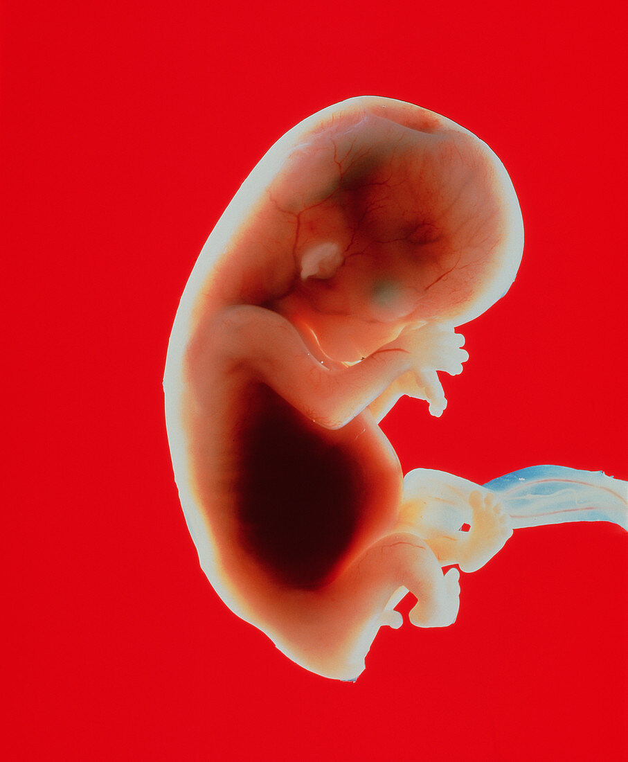 Foetus at 11 weeks