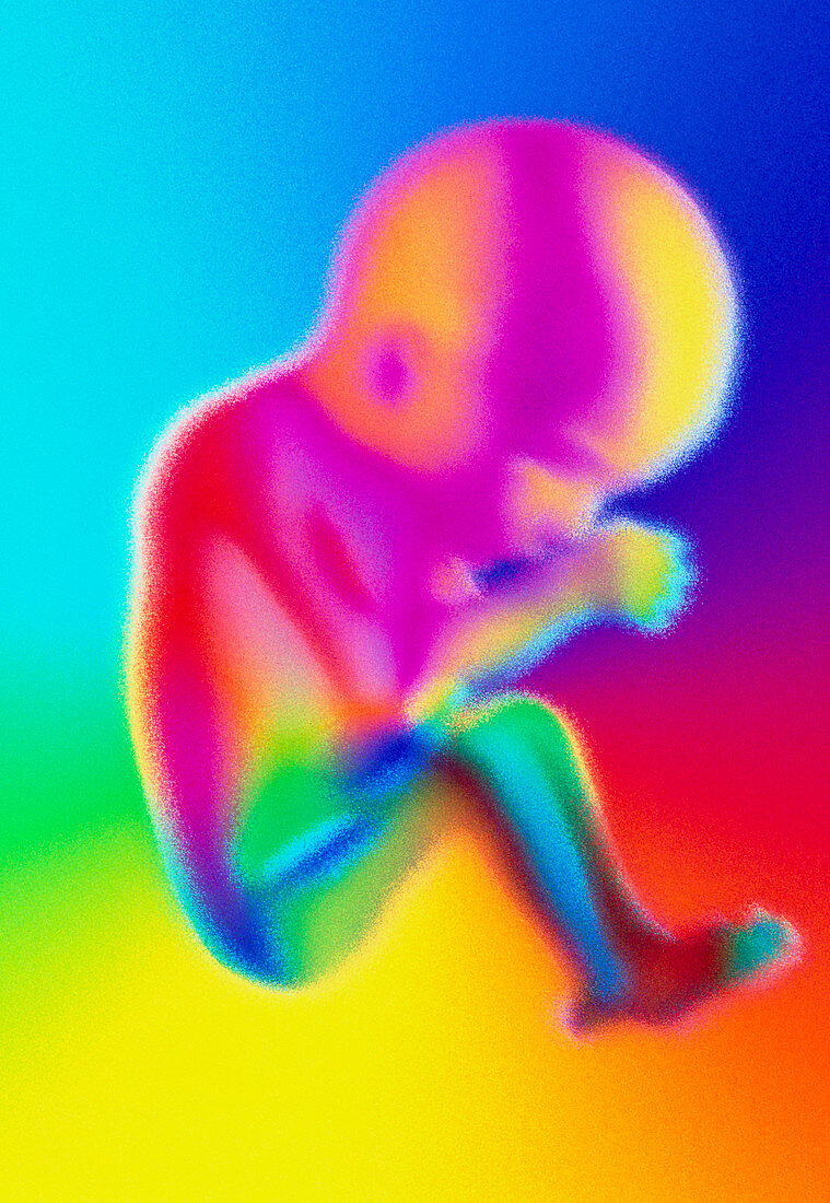 Computer graphic of a 15 week old human foetus