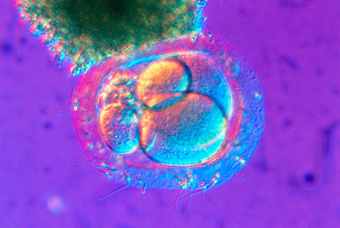 Light micrograph of fertilized human egg cell