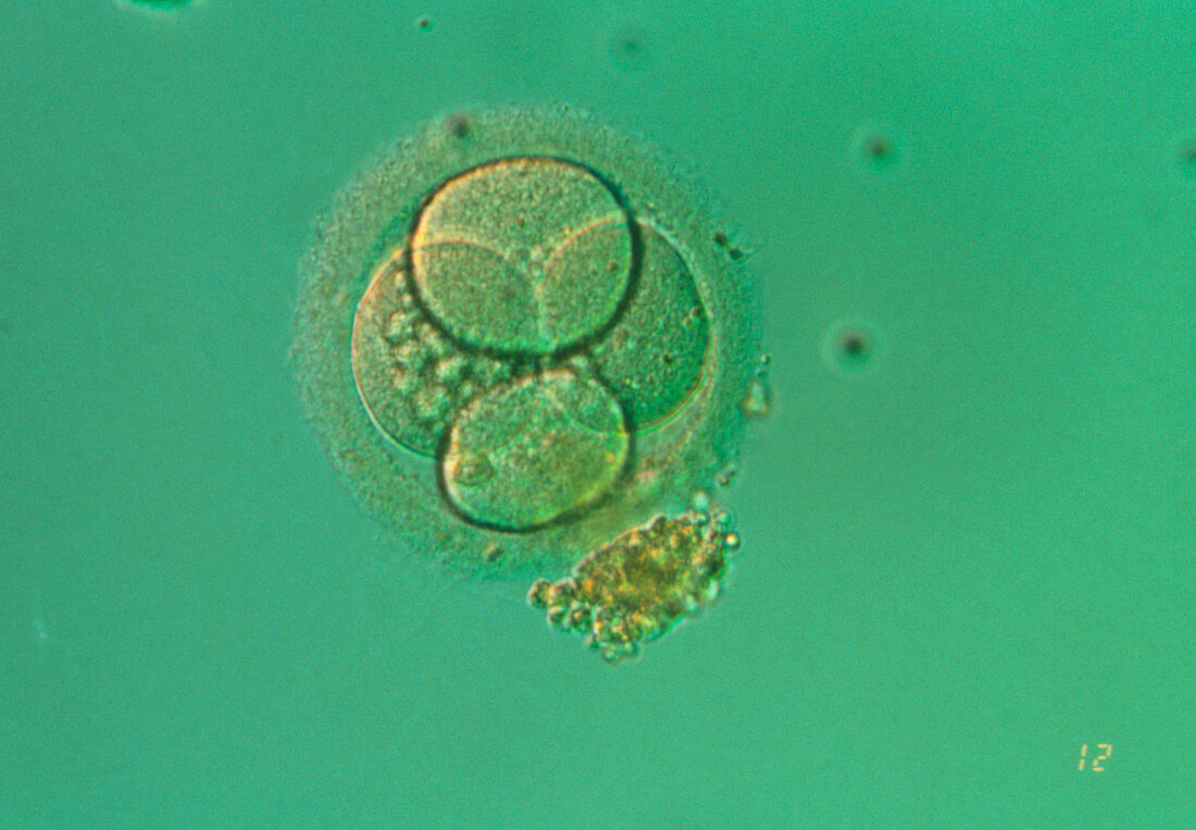 LM of human 4-cell stage embryo after IVF