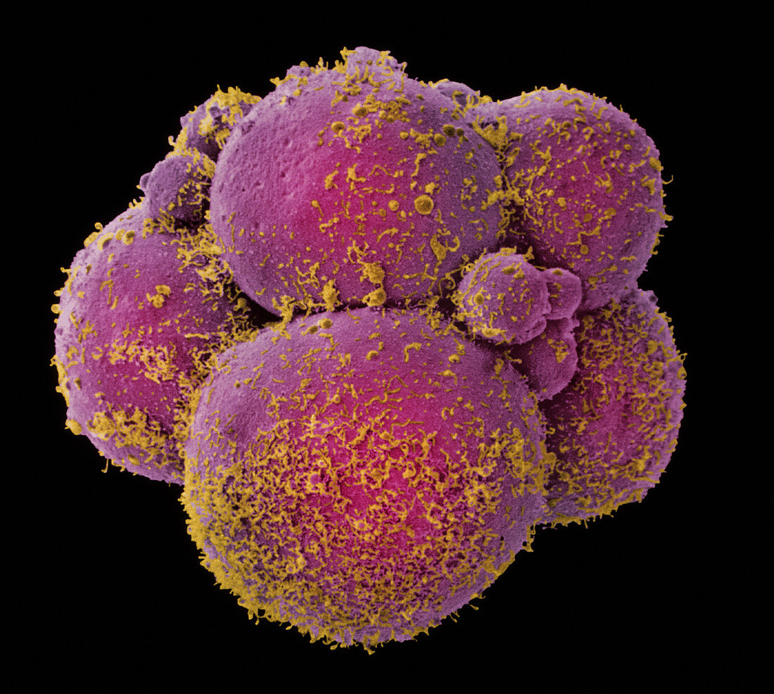 Coloured SEM of human embryo at 8-cell stage