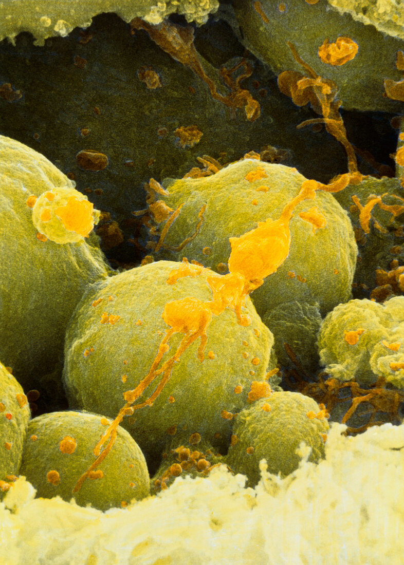 Coloured SEM of a 6-8 cell aborting embryo