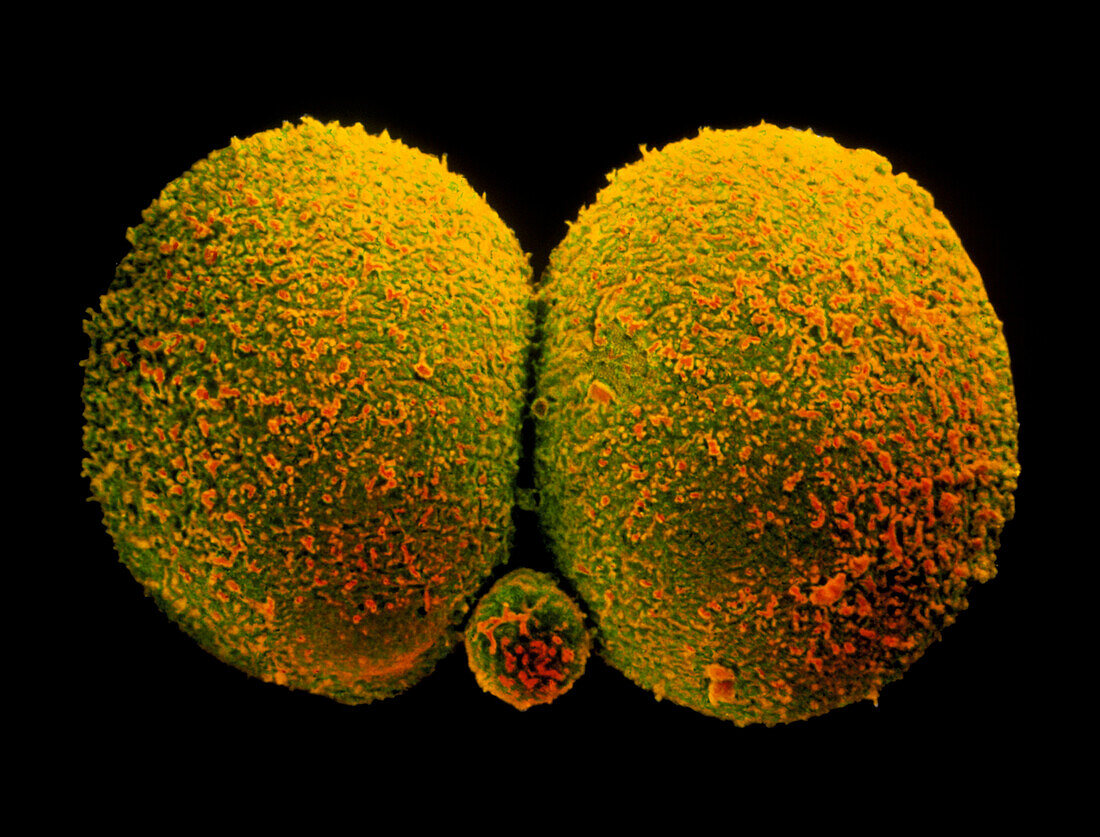 Coloured SEM of human embryo at the 2-cell stage