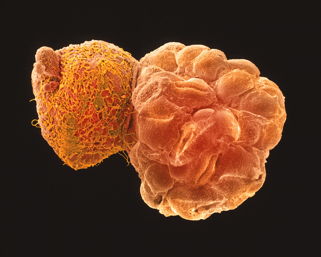 Coloured SEM of a hatching blastocyst 5 days old