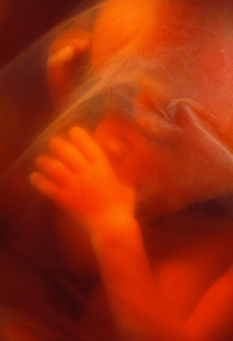 Face of 19 week old male foetus sucking his thumb