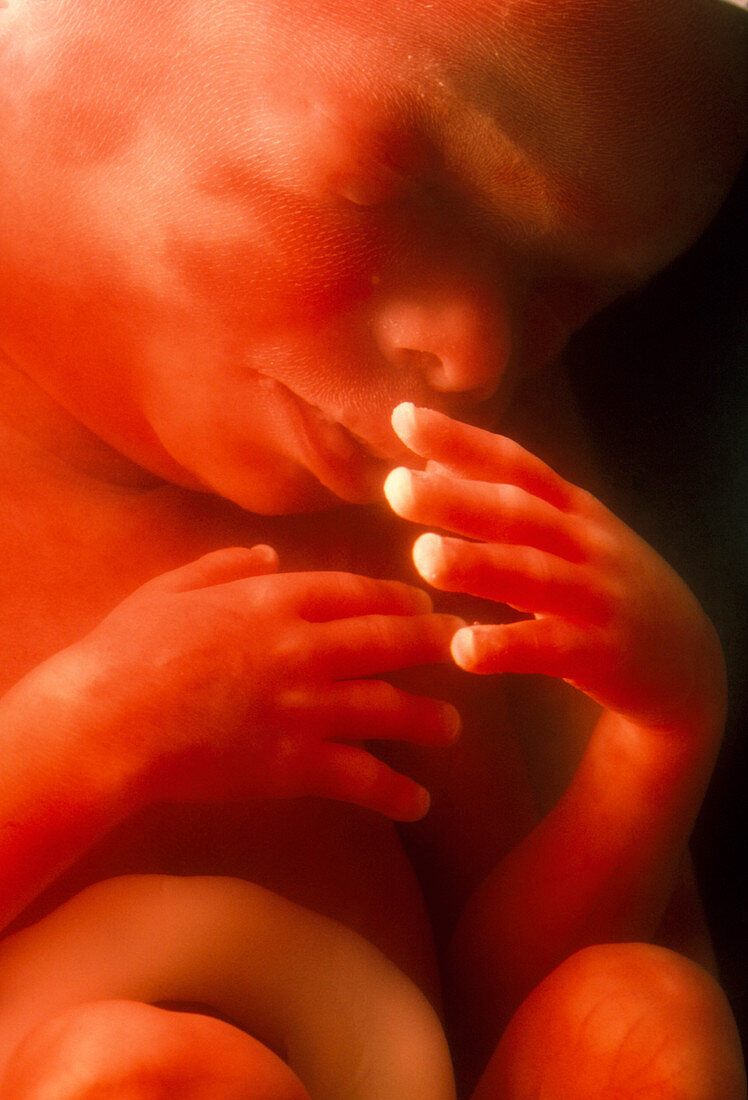 View of a 5 month old male foetus