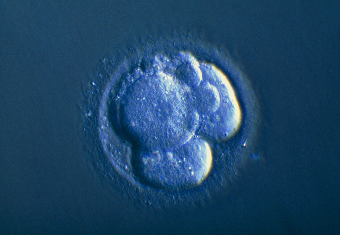 LM of a four-cell embryo showing its blastomeres