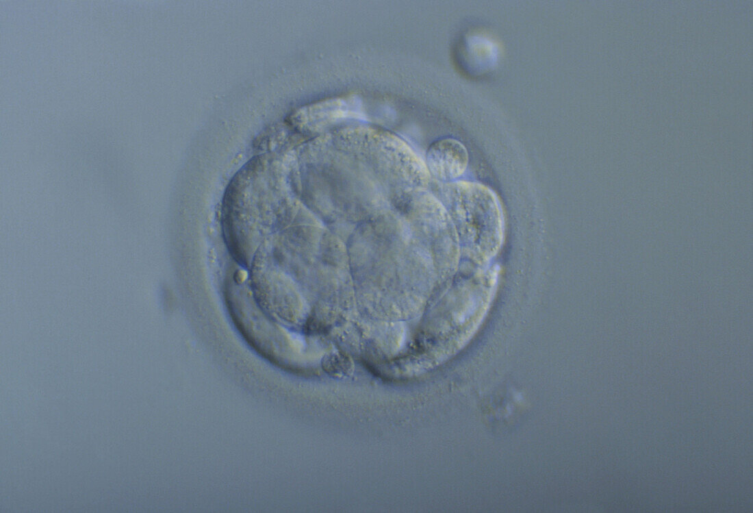 Morula embryo