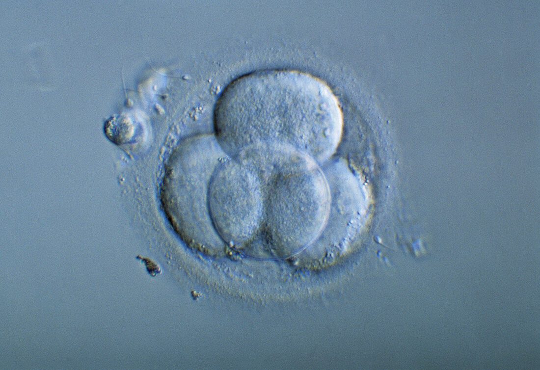 Light micrograph of a four-cell embryo