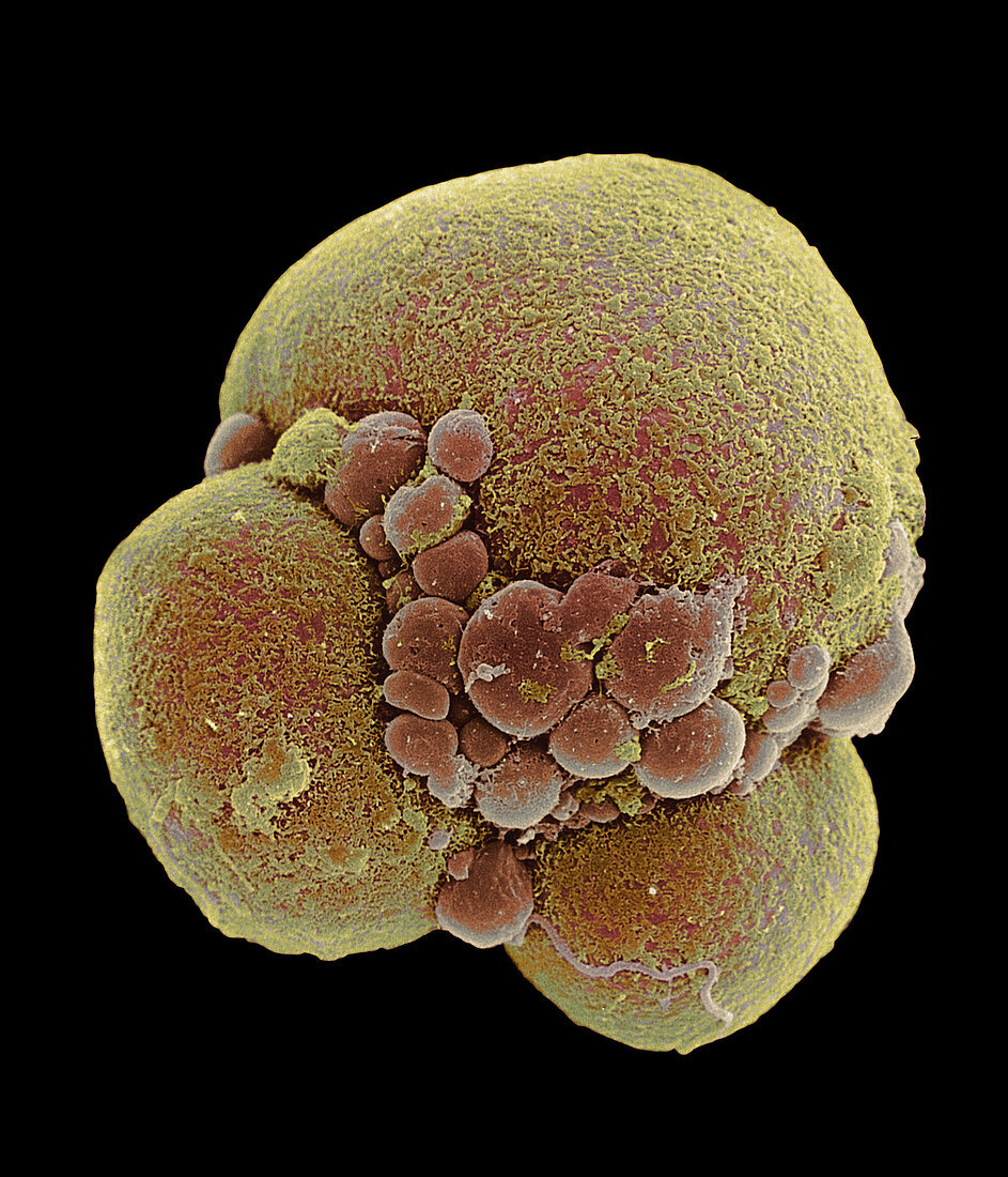 Four-cell embryo