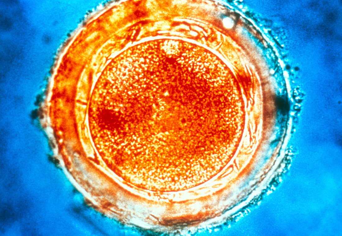 Fertilised human egg