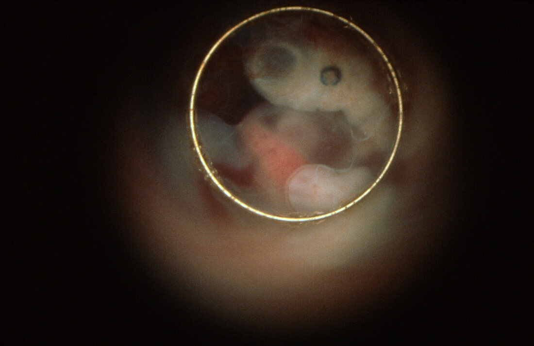 Human embryo showing eye