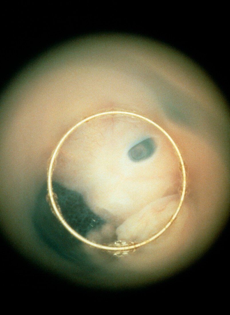 Human foetus showing face