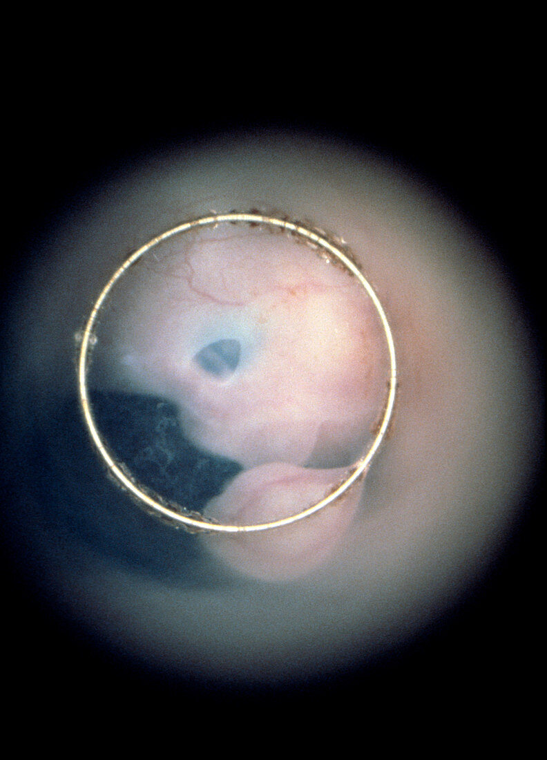 Human embryo: face