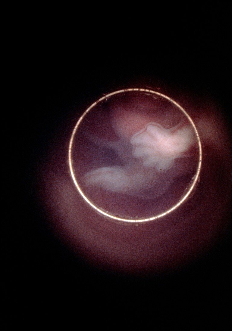 Human embryo: hand and foot