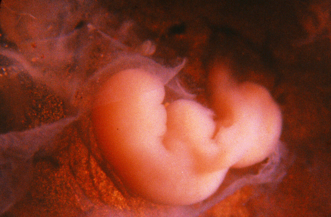 Embryo aged 4 weeks