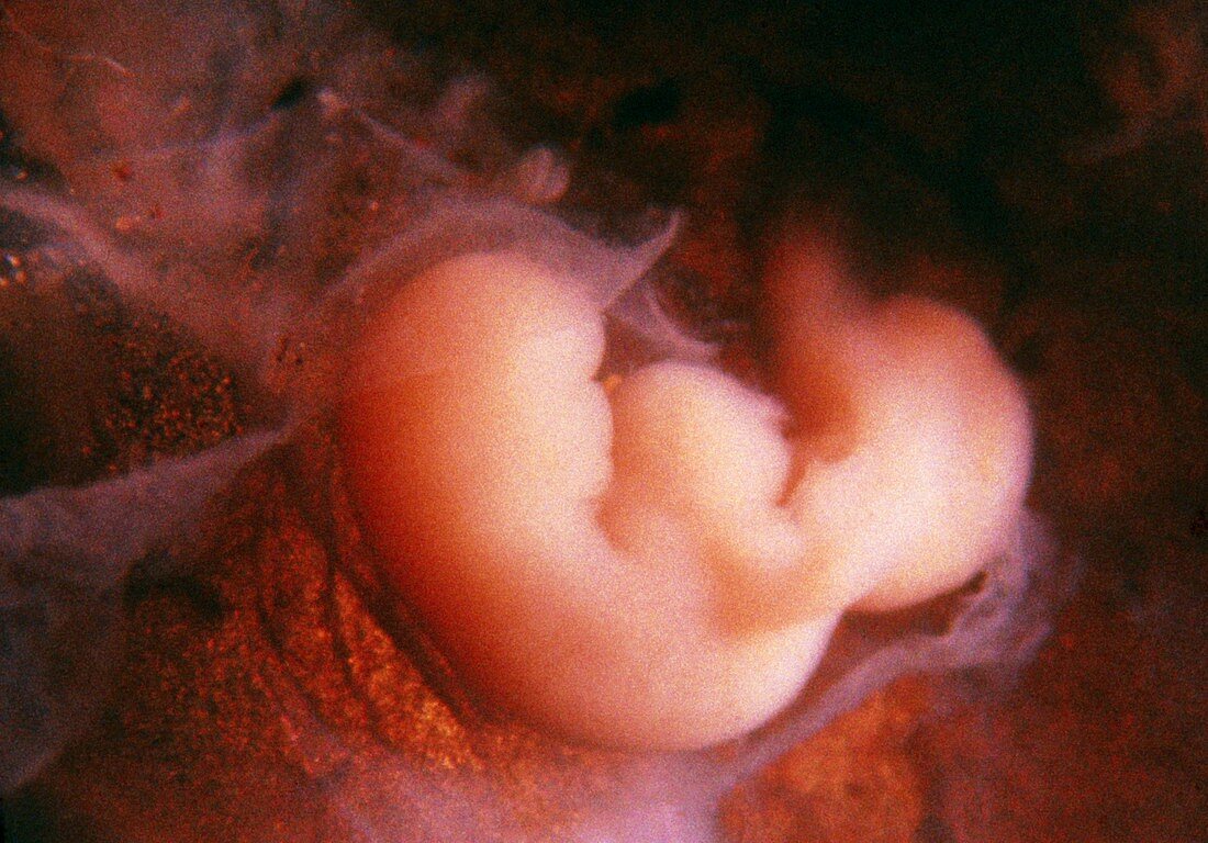 Embryo aged 28 days