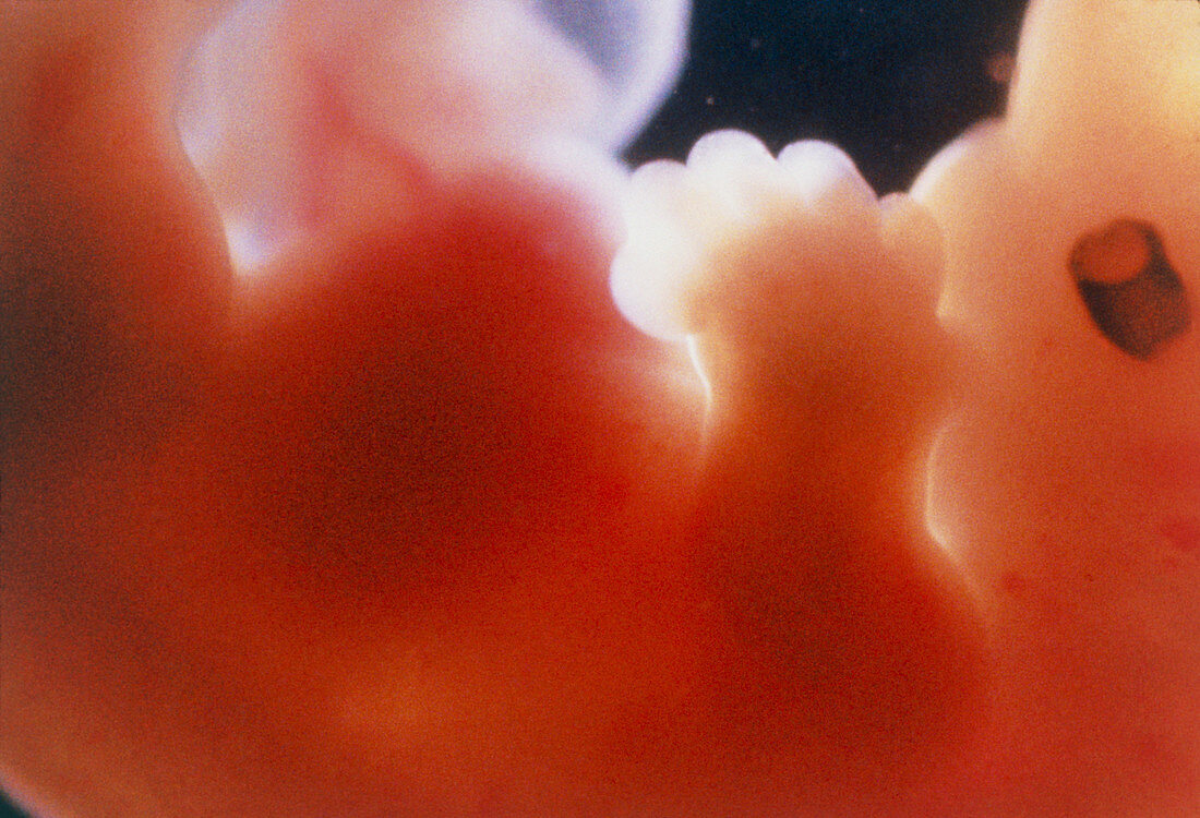 Embryo aged 7 weeks