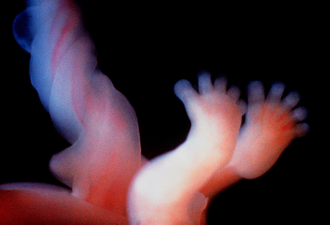 Foetus feet