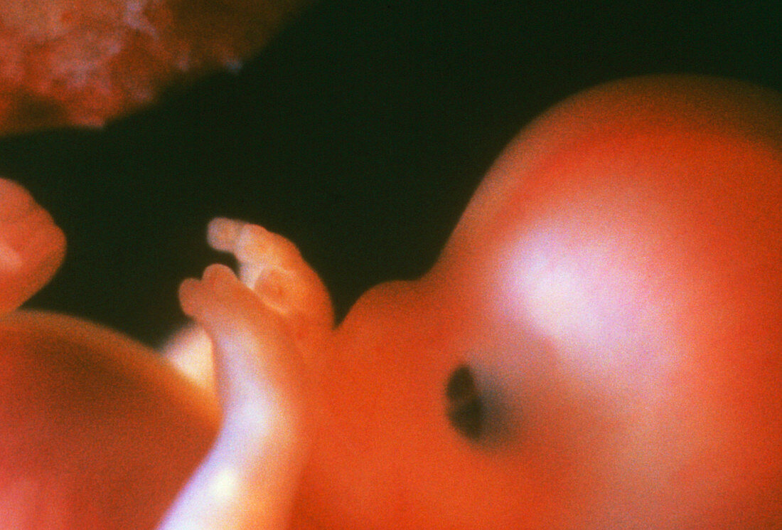 Foetus aged 10 weeks