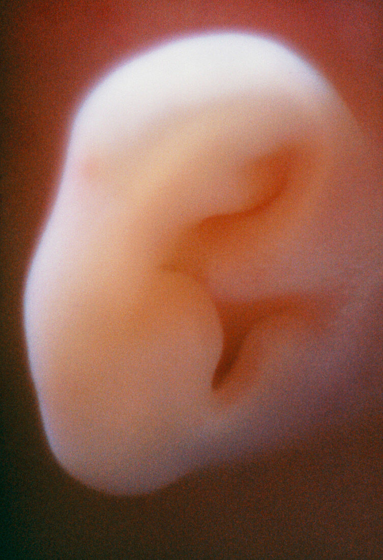 Ear of five month old foetus