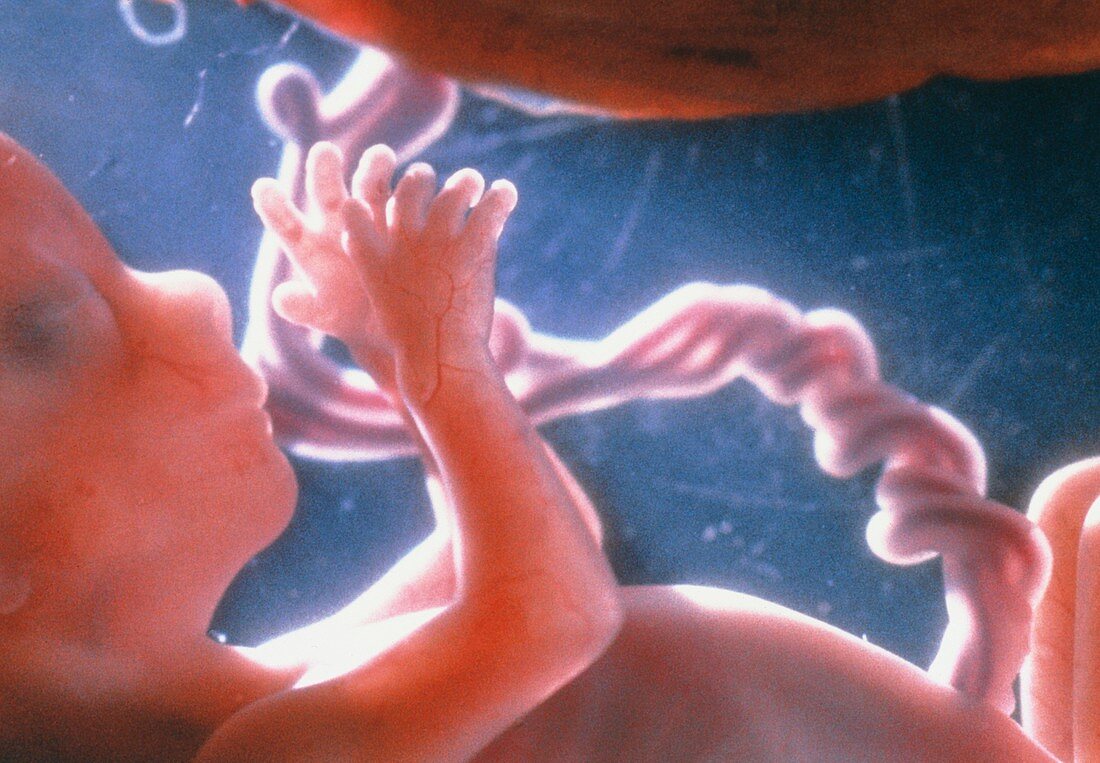 Foetus aged 12 weeks