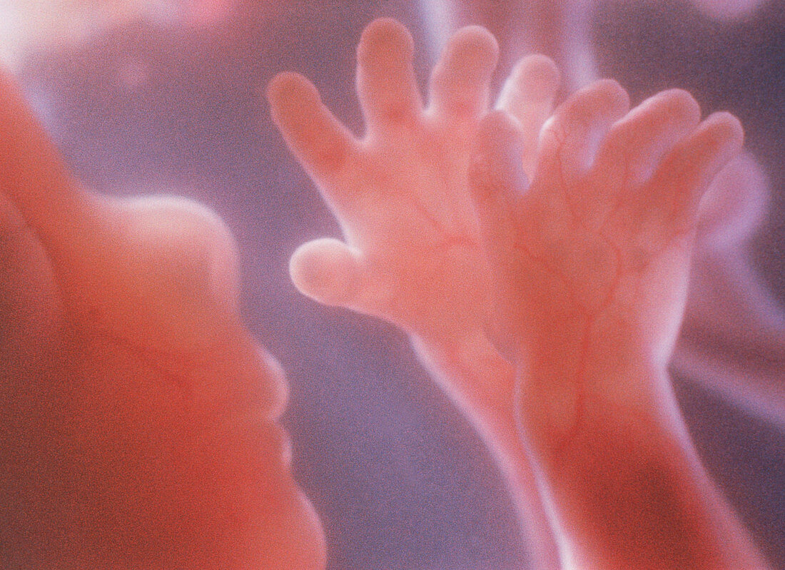 Human foetus at five months