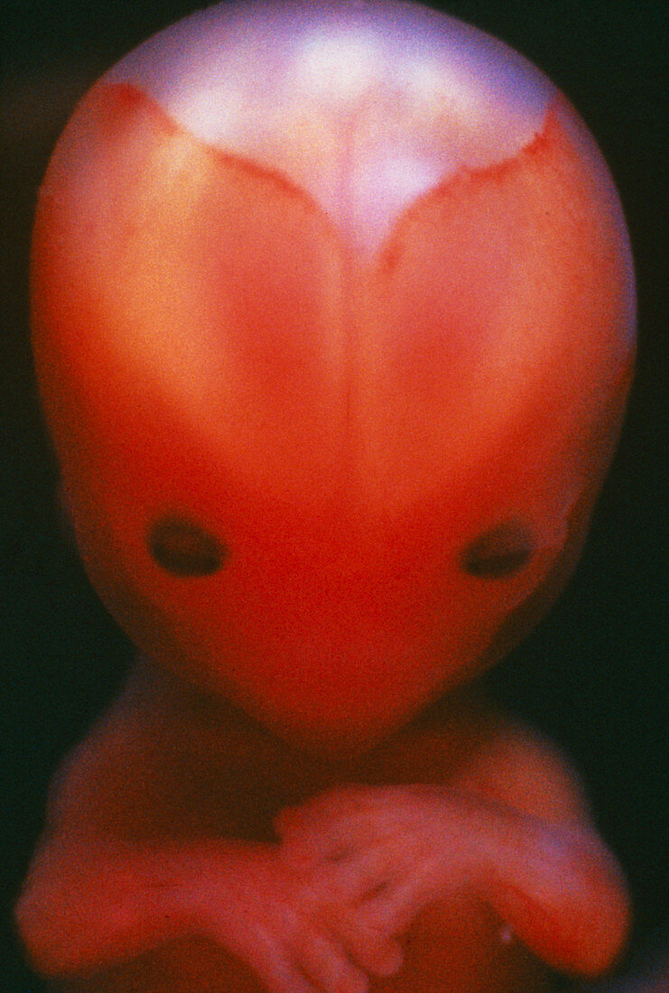 Head of a 12 week old foetus