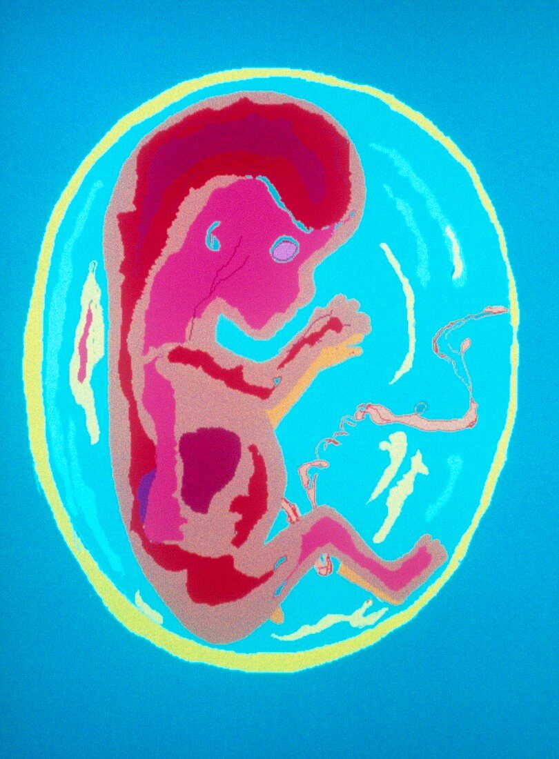 Computer graphics image of foetus at 14 weeks