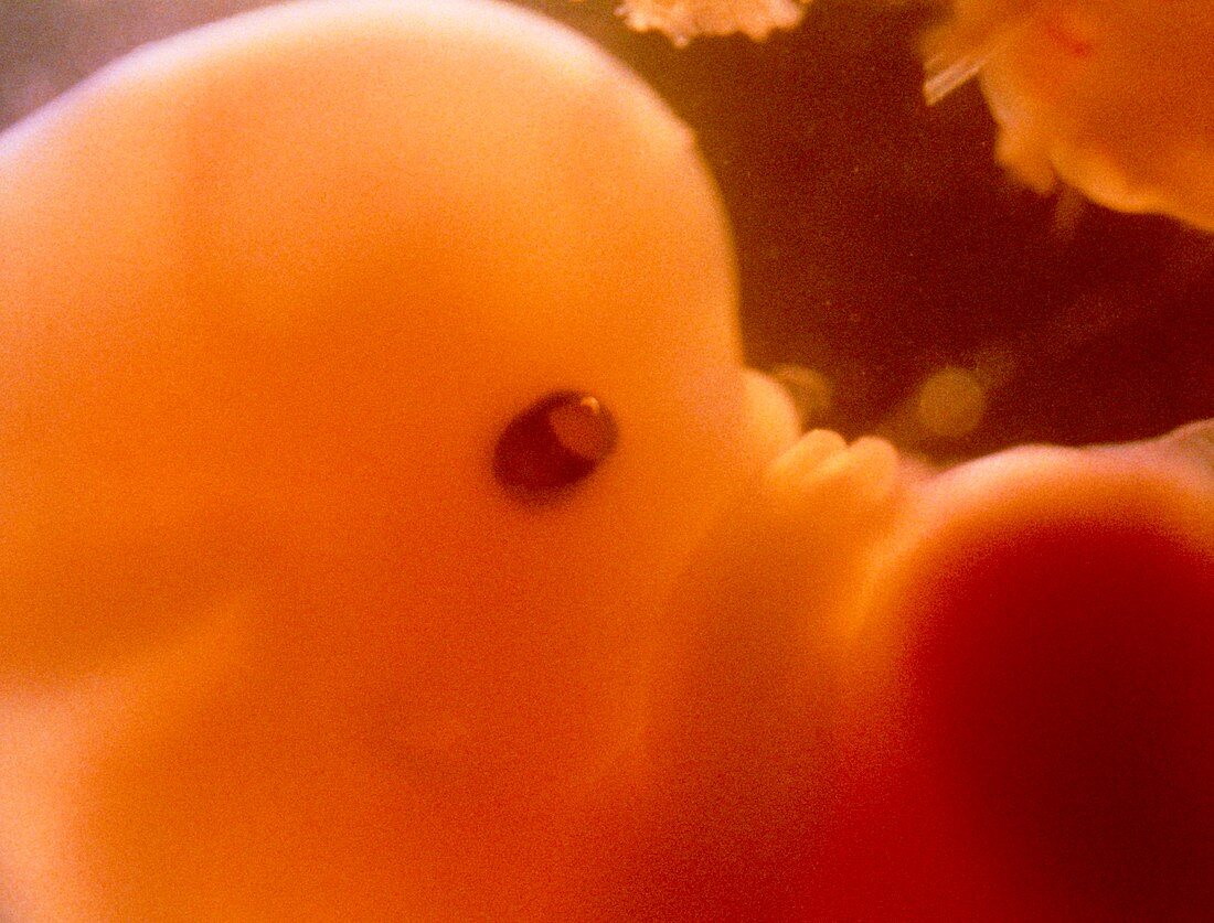 Human embryo after 7 weeks