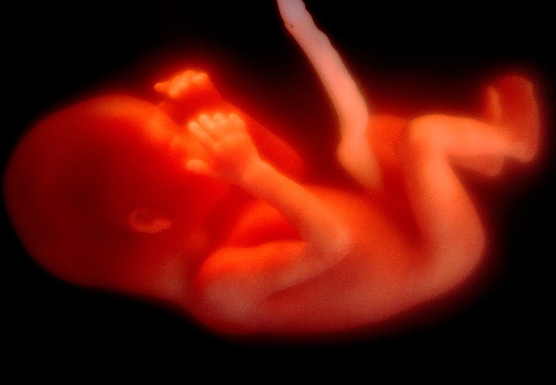 Foetus at 17 weeks