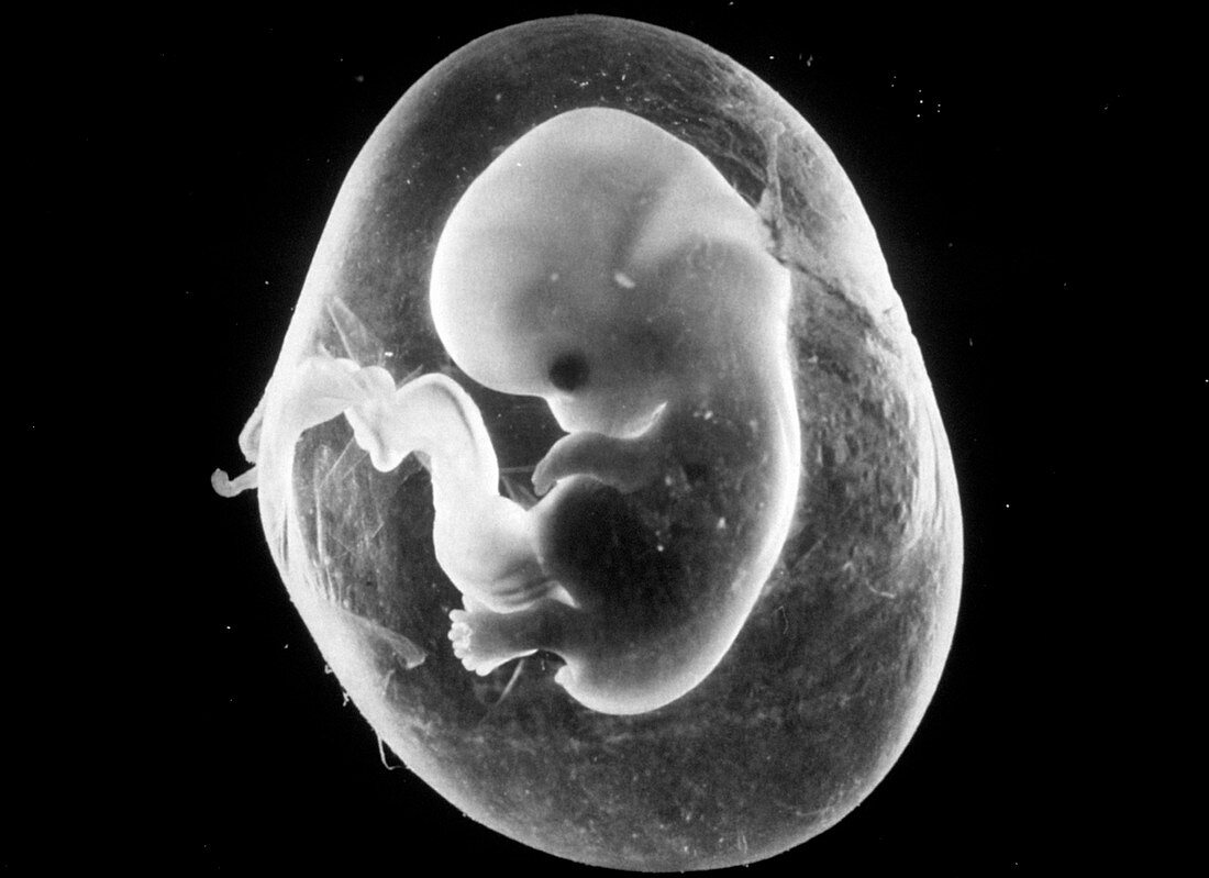 An eight week human fetus