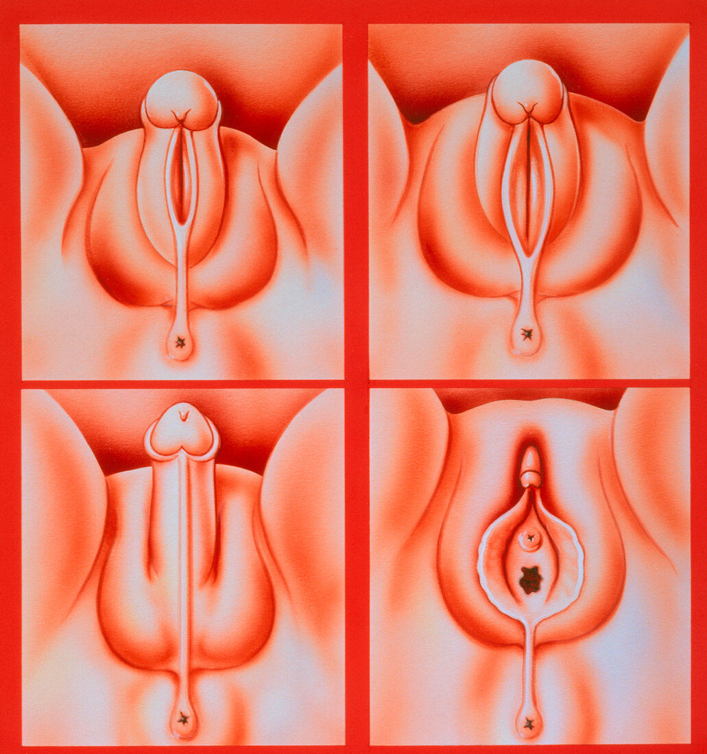 Illustration of fetal genital development