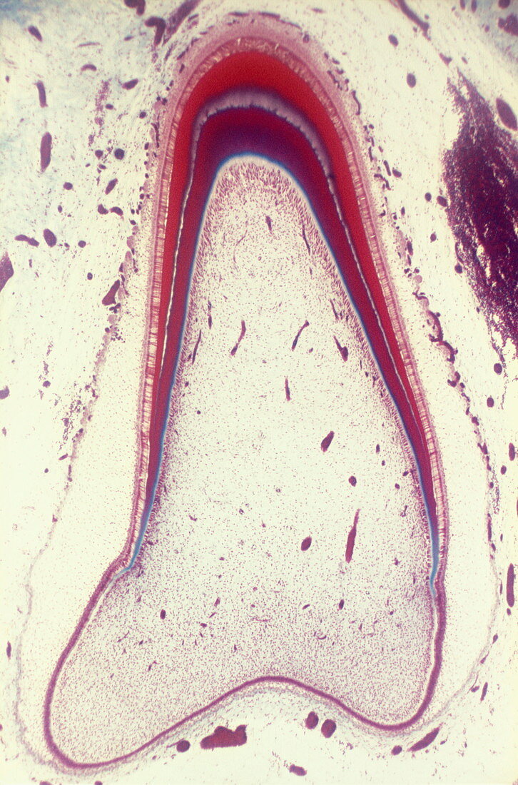 Unerupted foetal tooth,light micrograph