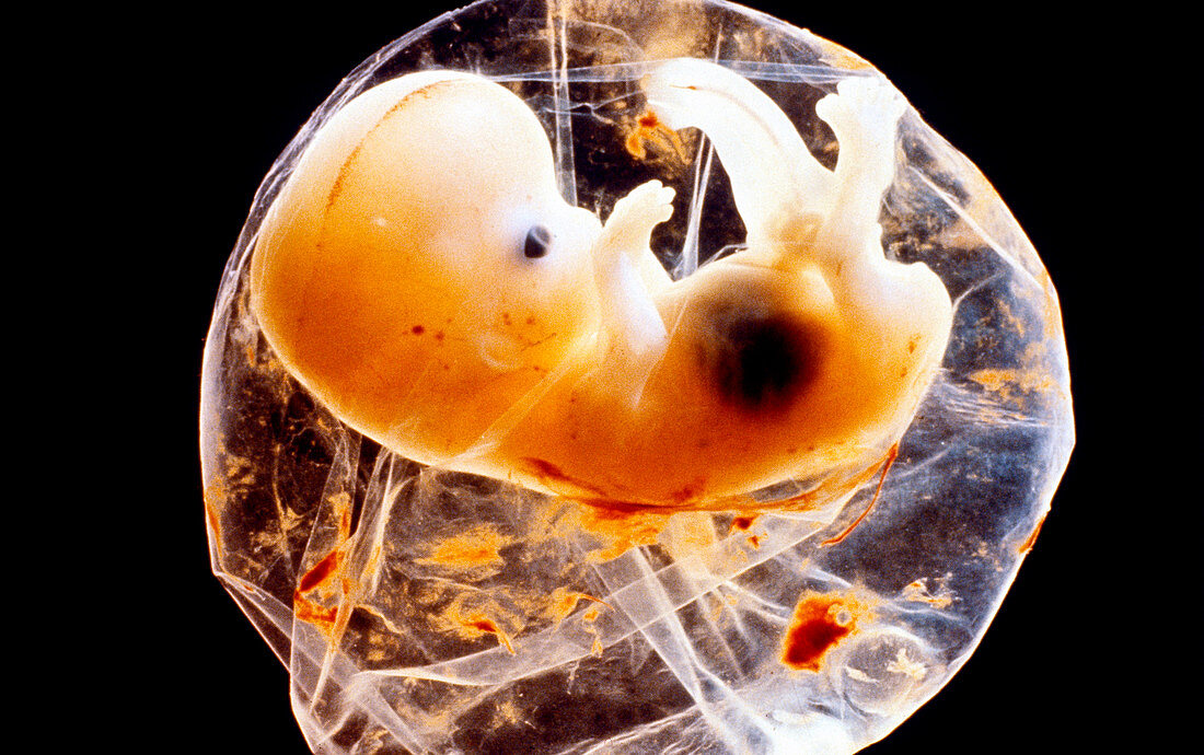 Six week old embryo