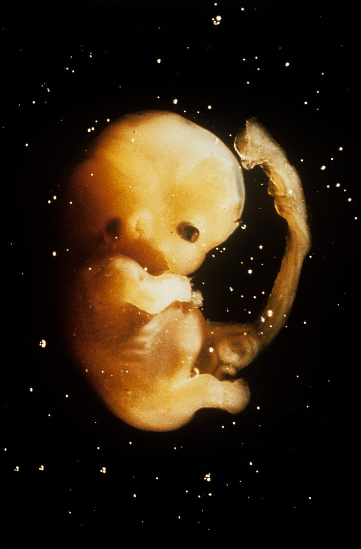 Embryo at seven weeks