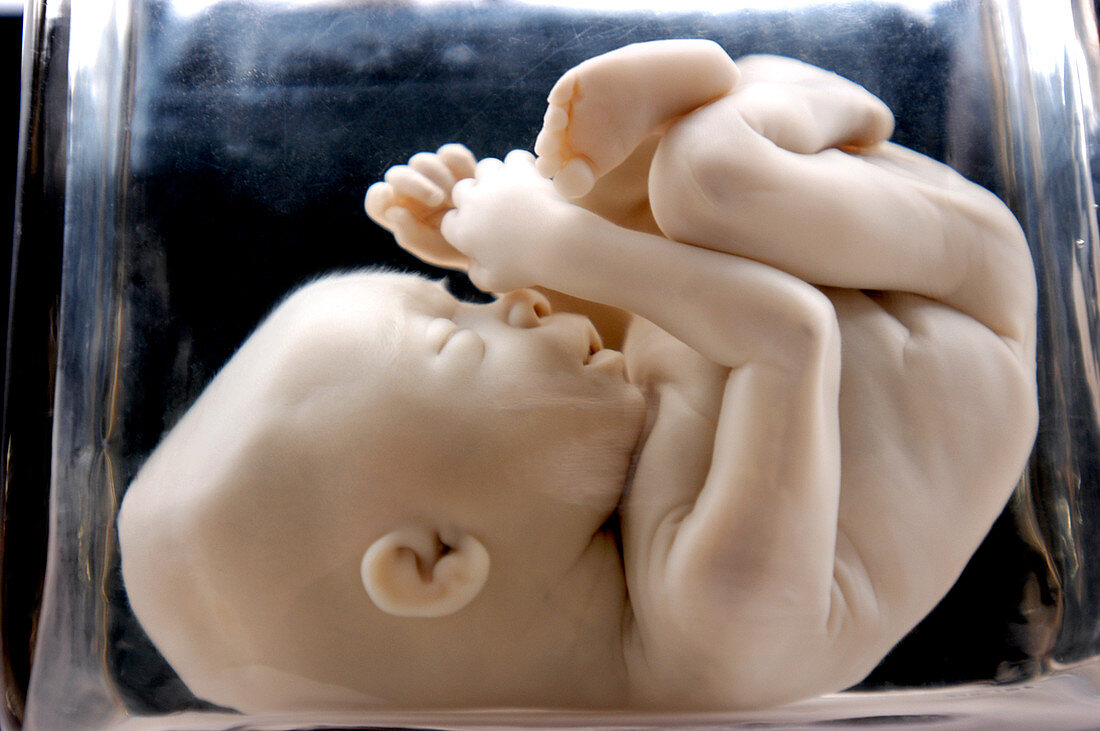 Foetus at 18 weeks