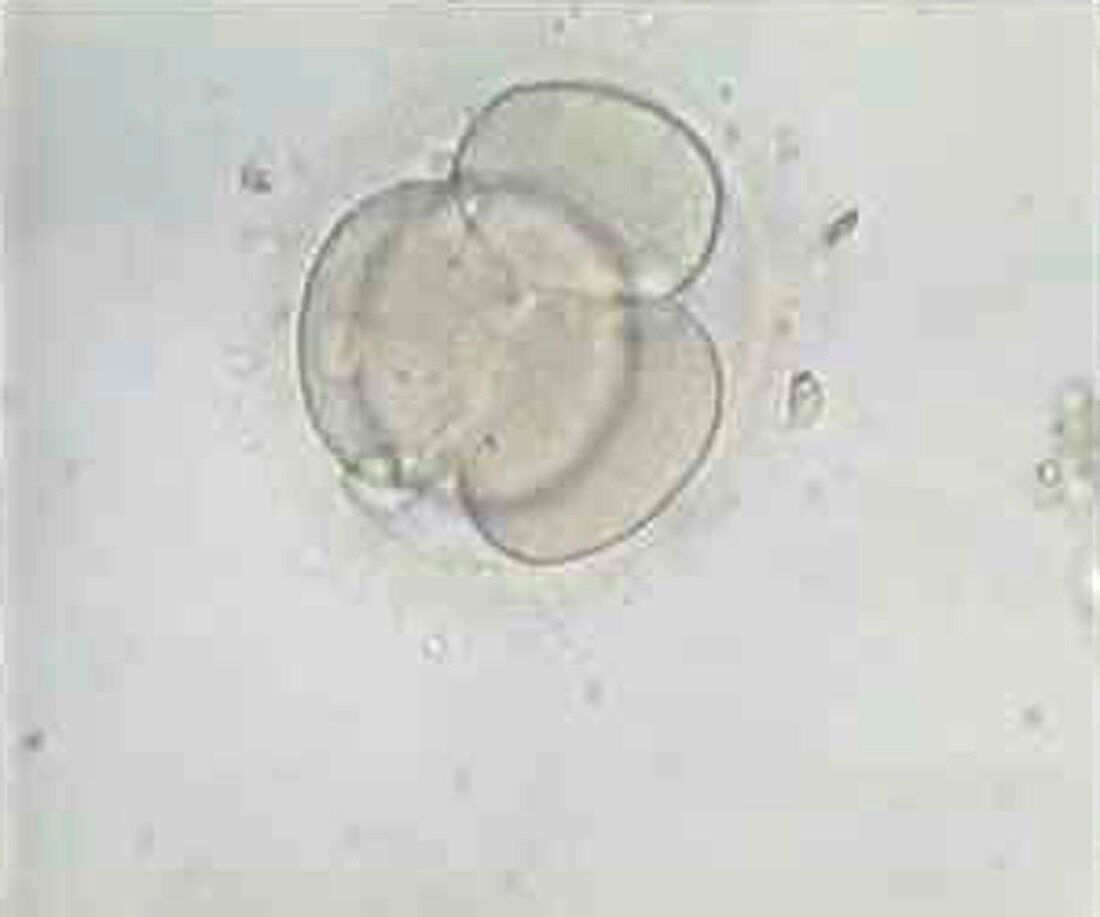 4-cell embryo,light micrograph