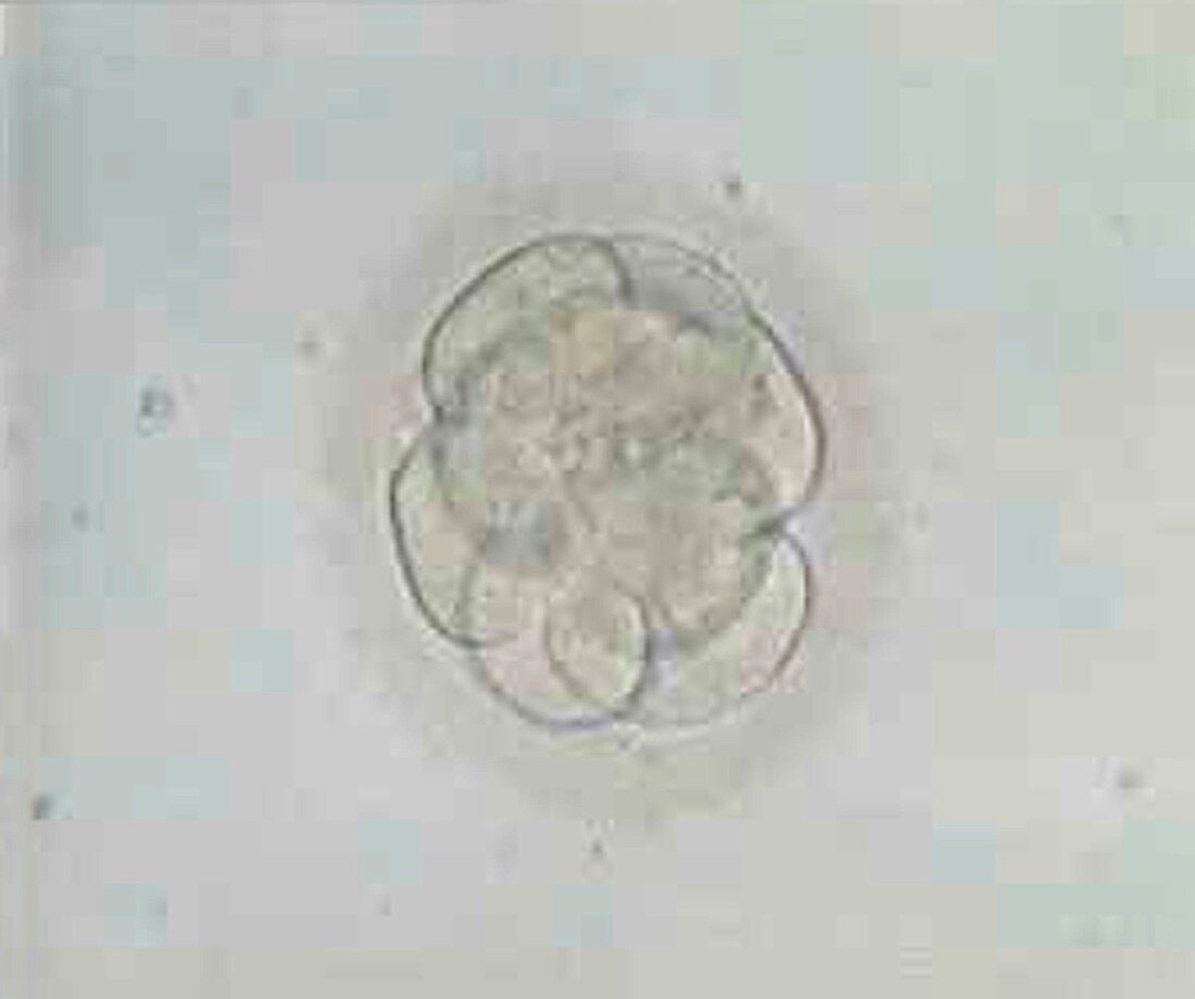 Multi-celled embryo,light micrograph